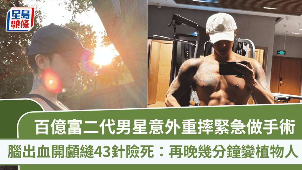 百亿富二代男星意外重摔紧急做手术  脑出血开颅缝43针险死：再晚几分钟变植物人