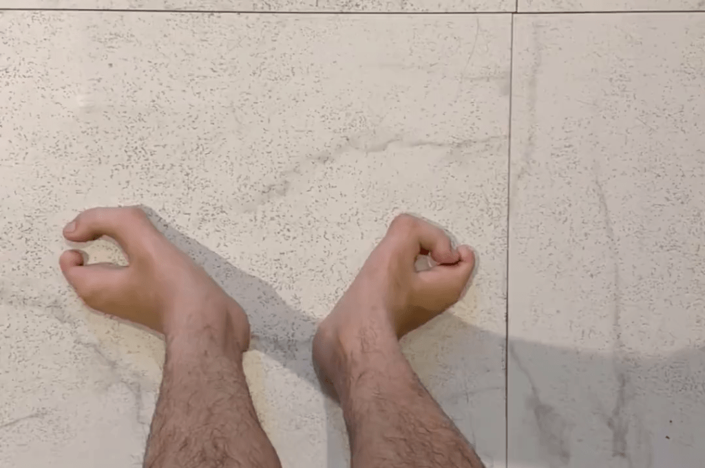 村裡人私下稱作「牛蹄腳」。