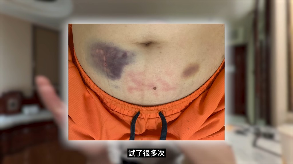 大J指太太先後六次接受人工代孕,不斷打鋒。 大J指太太先後六次接受人工代孕,不斷打鋒。