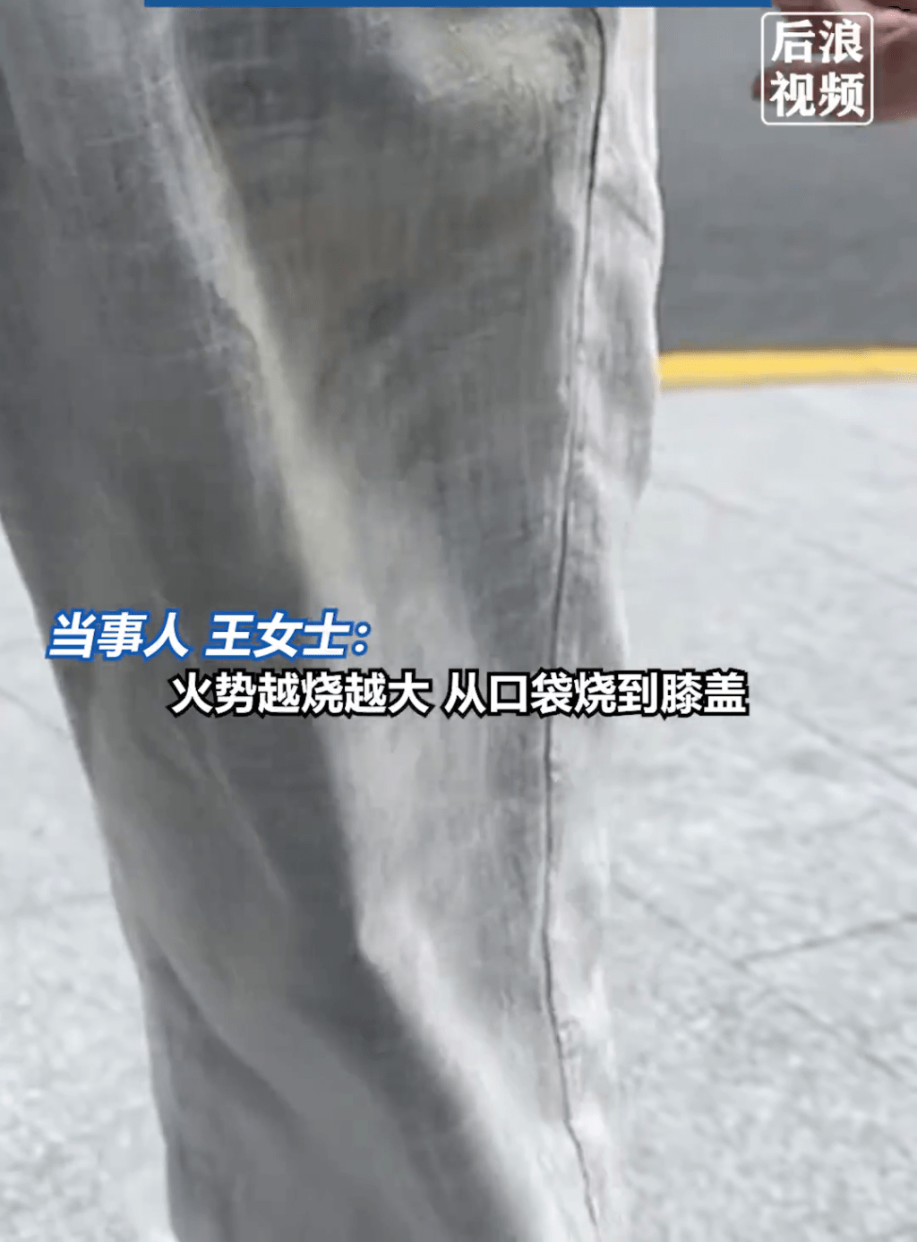 上海一男子褲袋羅馬仕「尿袋」自燃,致腿部三級燒傷,需植皮。 後浪視頻 上海一男子褲袋羅馬仕「尿袋」自燃,致腿部三級燒傷,需植皮。 後浪視頻