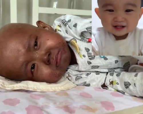 河北一名兩歲女童，自小皮膚白嫩、不幸確診血癌，爸爸為她移植骨髓，可之後出現各種不適，皮膚逐漸發黑。（網圖）