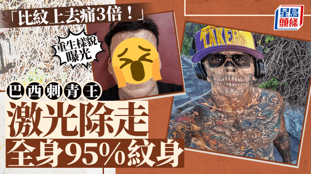 「巴西刺青王」宣布洗掉全身95%紋身：比紋上去痛三倍