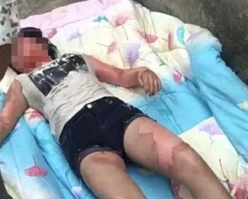 吳女傷勢嚴重,狀甚痛苦。(網圖)