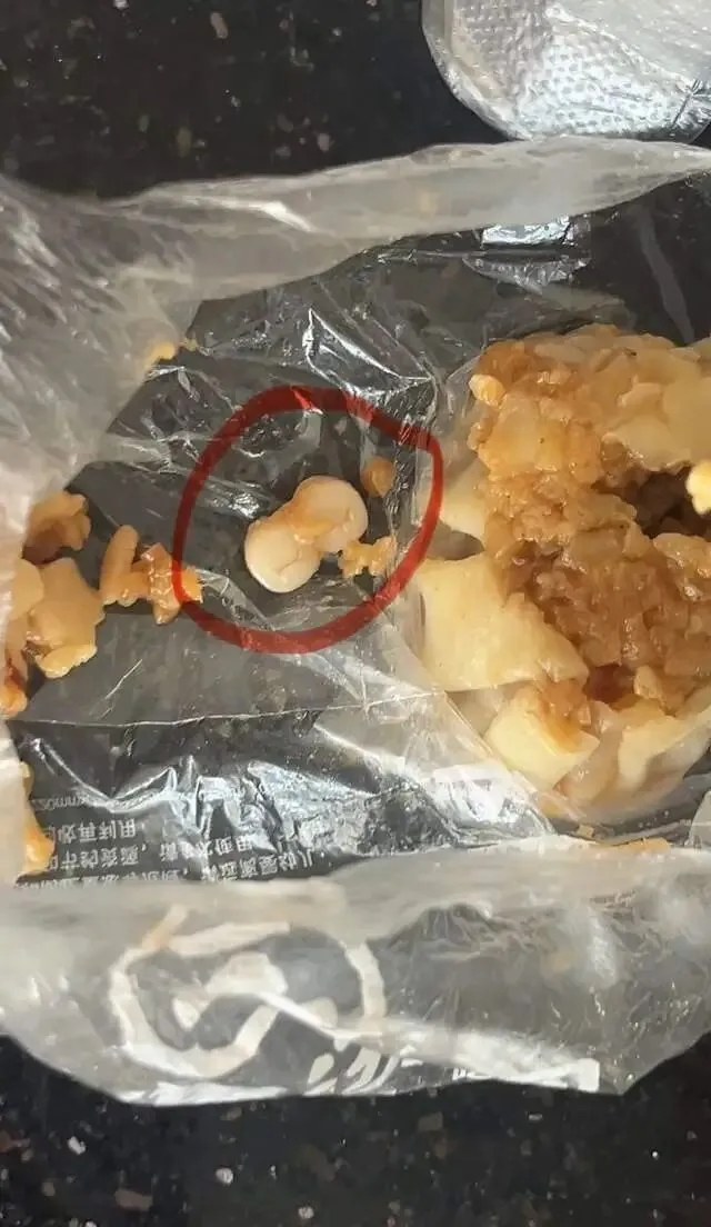 東莞食客燒賣吃出兩顆相連牙齒。 東莞食客燒賣吃出兩顆相連牙齒。