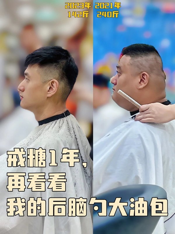 頸部脂肪明顯減少。(圖片來源:「明叔很認真」小紅書)