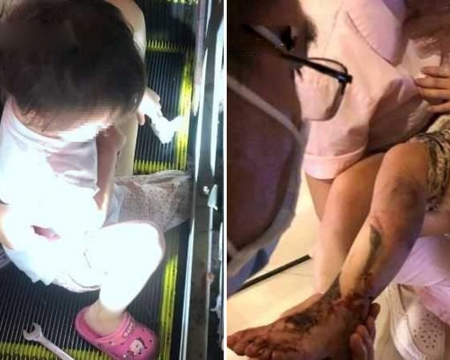 深圳4歲女童小腿被捲入扶手電梯縫隙。