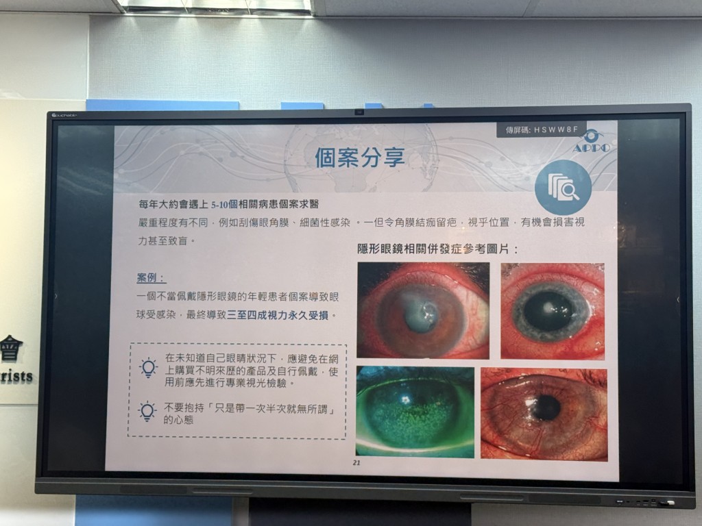 若未經正確驗配或使用不當隱形眼鏡,容易引發角膜炎、細菌感染及視力損傷等問題。何姵妤攝 若未經正確驗配或使用不當隱形眼鏡,容易引發角膜炎、細菌感染及視力損傷等問題。何姵妤攝