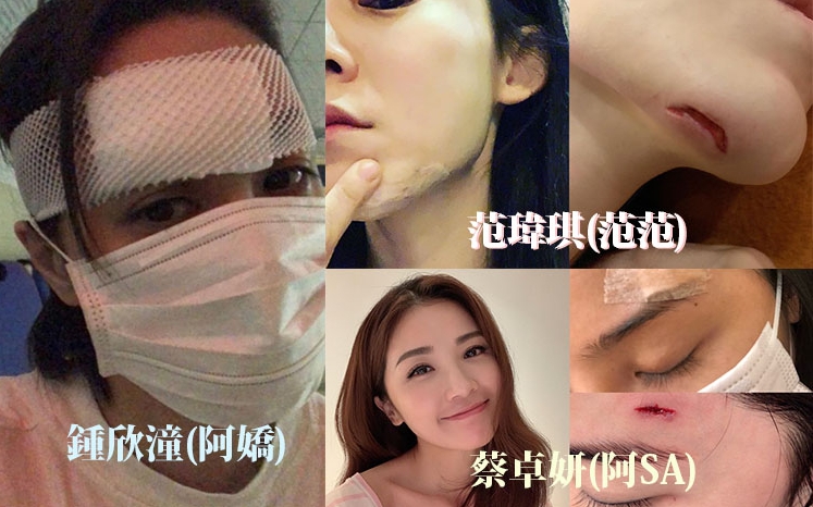 藝人最想係走紅,最怕係見紅,不少藝人都試過意外受傷見紅,一齊回顧一吓並引以為戒。