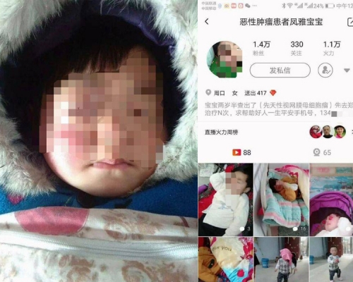 河南一對夫婦懷疑利用患有眼癌的3歲女兒，在社交網絡發起籌款。（網圖）