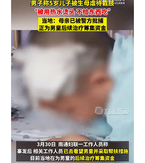 男童被生母用熱水燙頭受傷。