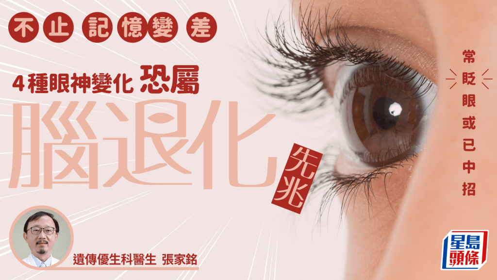不止記憶變差！醫生揭4種眼神恐屬腦退化先兆 常眨眼或已中招