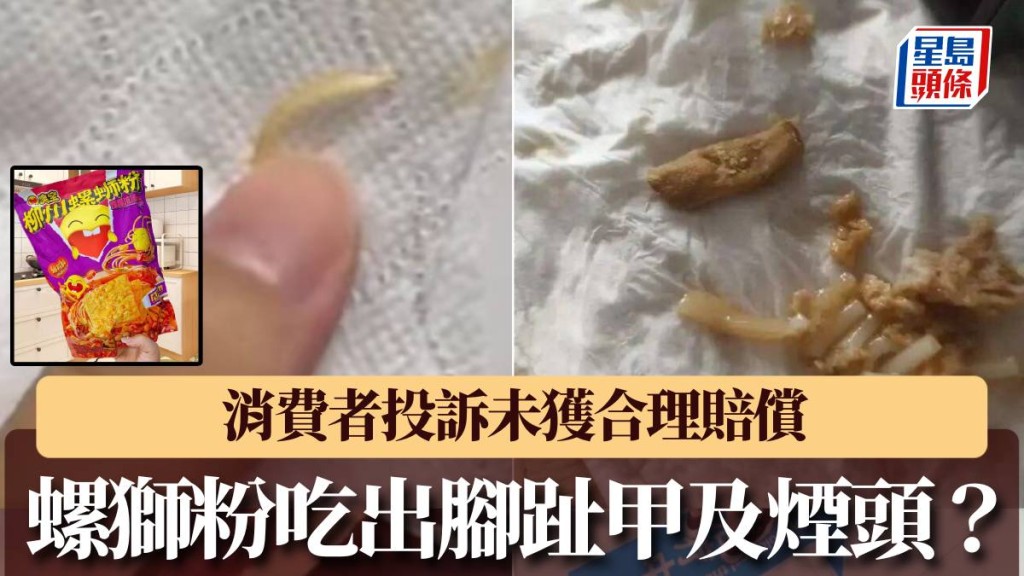 知名螺獅粉吃出疑似腳趾甲及煙頭等異物。
