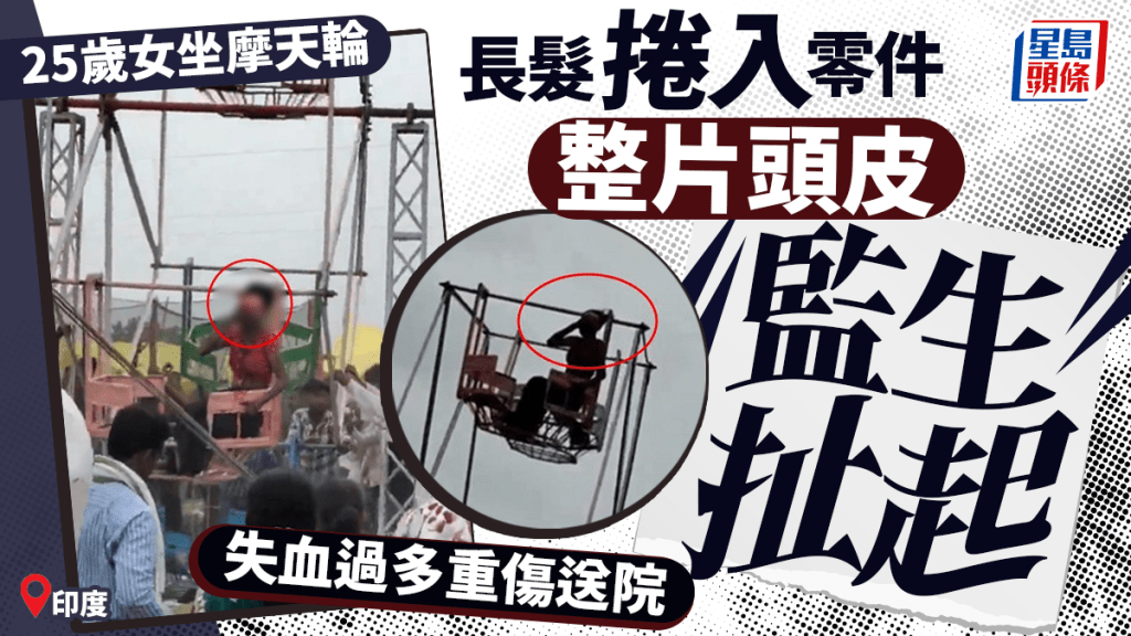 摩天輪驚魂｜印度女長髮遭捲「整片頭皮」監生扯起  失血過多重傷送院