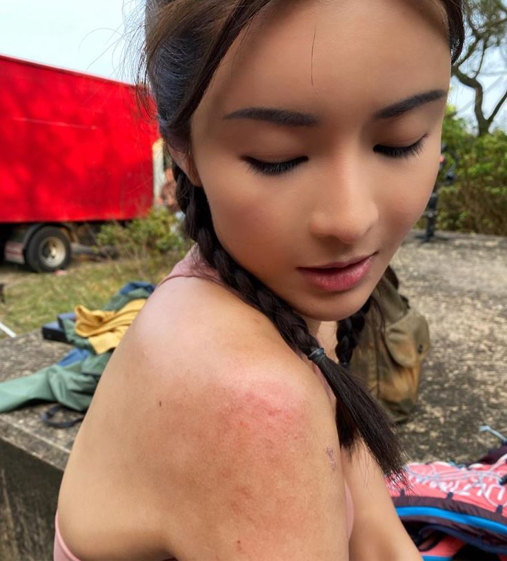 不慎真的碌落山,擦損雙臂。