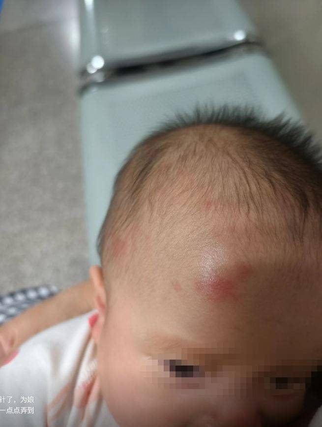 「洢諾」女兒被撞至滿頭傷。抖音
