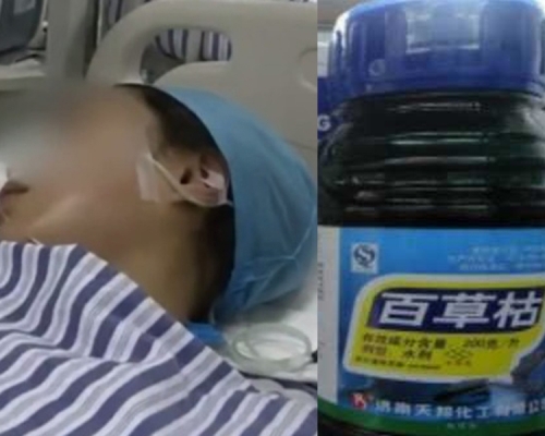 女童咳嗽不止欲喝止咳藥，卻誤服百草枯，生命垂危。（網圖）
