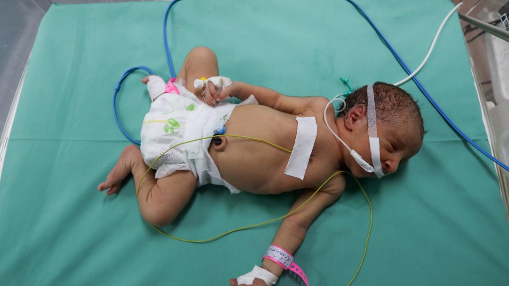 一名早產巴勒斯坦嬰兒躺在希法醫院產科病房的保溫箱裏，衞生官員稱，該院因燃料和電力耗盡，將要關閉。 路透社