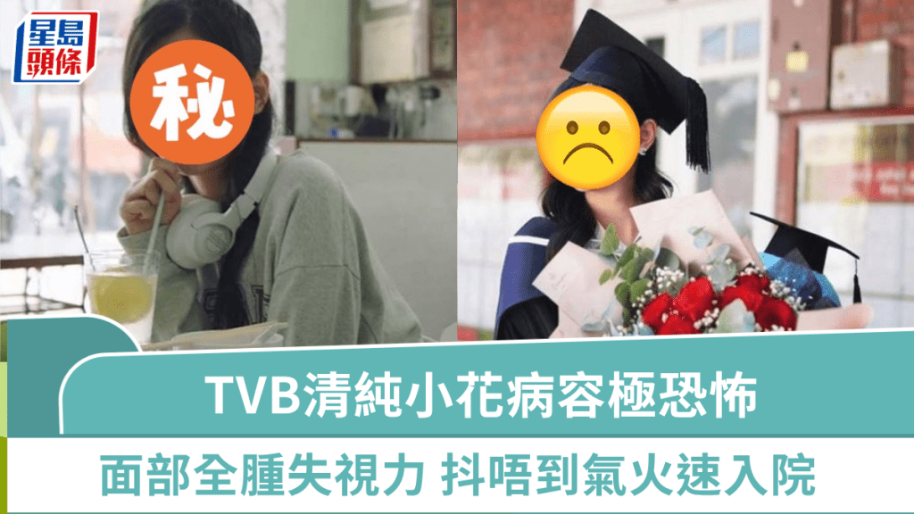TVB最清純小花晒病容照極恐怖  半小時內面部全腫奪去視力  抖唔到氣火速入院