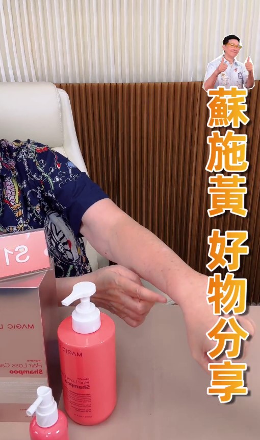 蘇施黃展示化療後遺症,左手手腕附近位置明顯凹陷,因為血管已被打死。 蘇施黃展示化療後遺症,左手手腕附近位置明顯凹陷,因為血管已被打死。