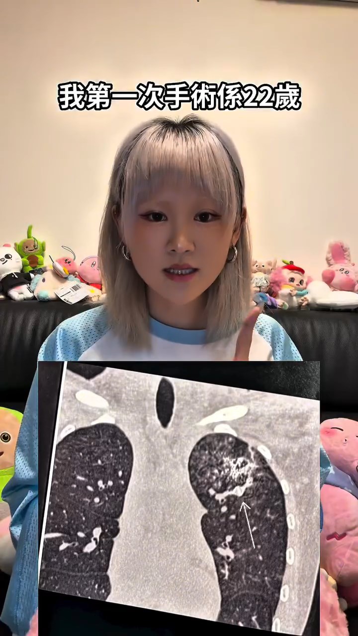 WinWin第一次做手術時只有22歲。 WinWin第一次做手術時只有22歲。