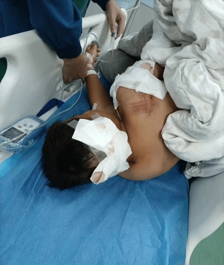 湖南10歲男童遭阿拉斯加犬咬傷要在ICU搶救。資料圖片
