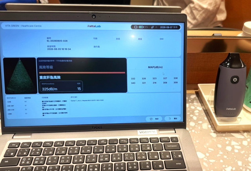 FattaLab®透過AIFF智能演算法,直接量化肝脂水平,並自動完成肝臟定位及質量控制,提供更客觀及標準化的肝臟脂肪含量評估結果。 FattaLab®透過AIFF智能演算法,直接量化肝脂水平,並自動完成肝臟定位及質量控制,提供更客觀及標準化的肝臟脂肪含量評估結果。