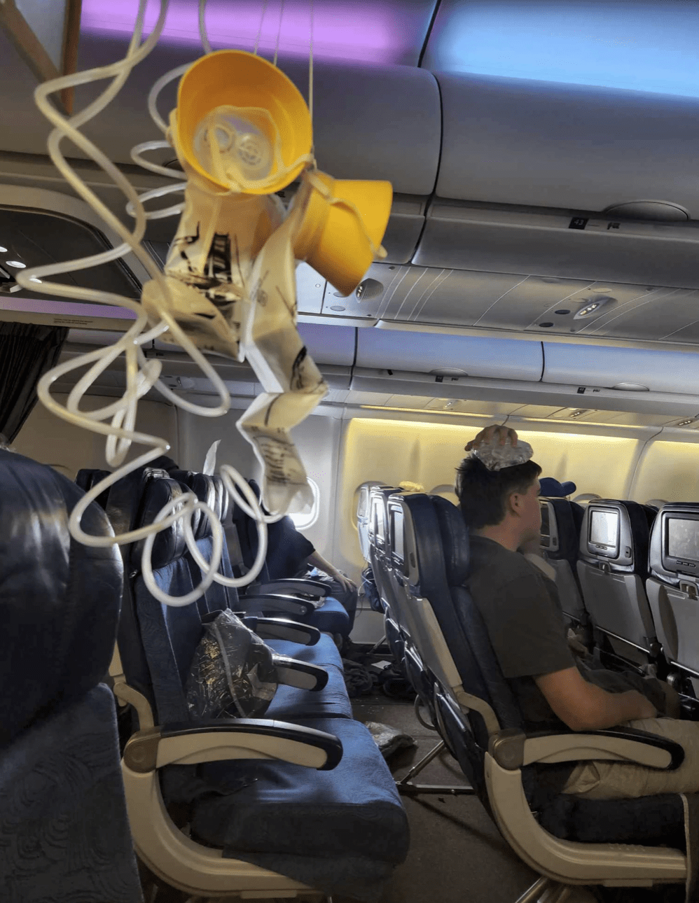 一名男乘客用冰袋敷头顶部位，旁边弹出了氧气面罩。美联社