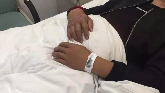 內地男被燒傷。