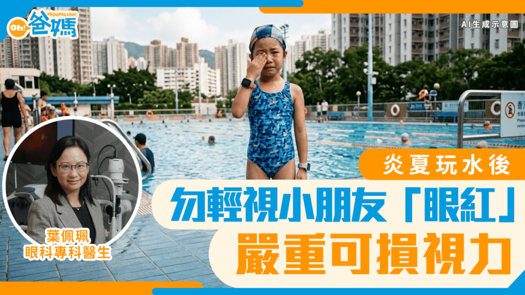 小朋友炎夏玩水后眼红勿轻视 感染性结膜炎严重可损视力｜儿童健康
