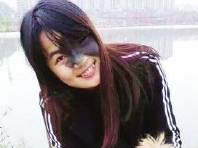 肖艳自出生起，脸上就长有巨型黑痣，几乎掩去半边脸庞。 网上图片