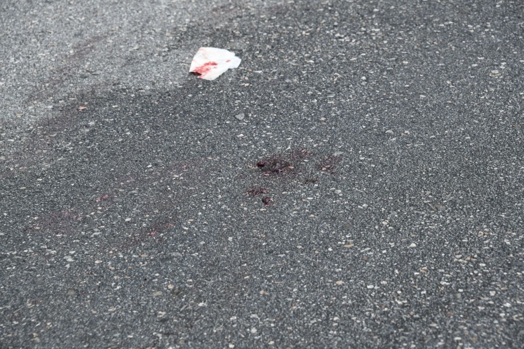 女途人被客貨車撞倒後頭部受傷，車禍現場事後遺留血紙巾及血迹。(楊偉亨攝)