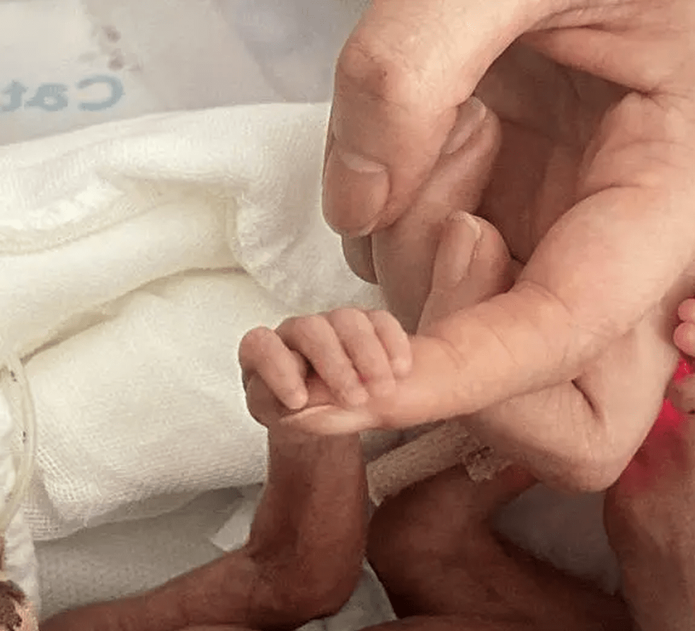 剛出生的喜悅手臂只有成人手指大小。