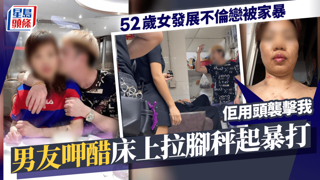 東張西望丨52歲女發展不倫戀被家暴！男友呷醋拉腳秤起暴打 涉事男：佢用頭襲擊我