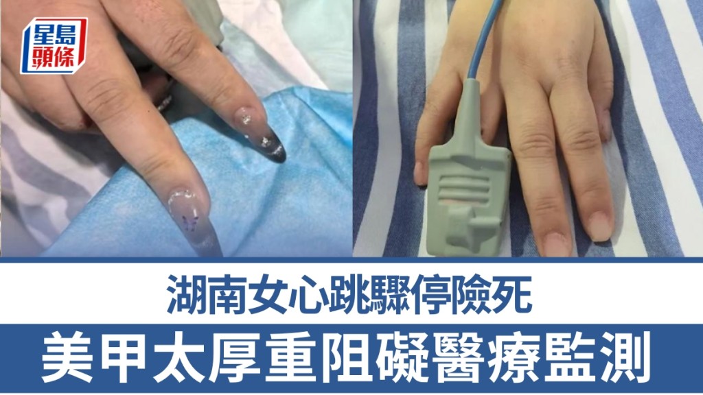 湖南女美甲太厚重，心臟病發阻礙搶救。
