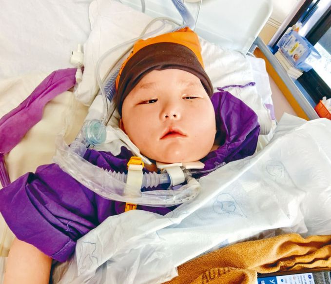 天瑜疑因醫療事故變為植物人。