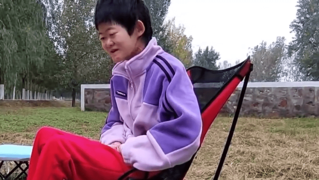 高尚好是內地首位接受分指手術的「蝴蝶寶貝」。 高尚好是內地首位接受分指手術的「蝴蝶寶貝」。