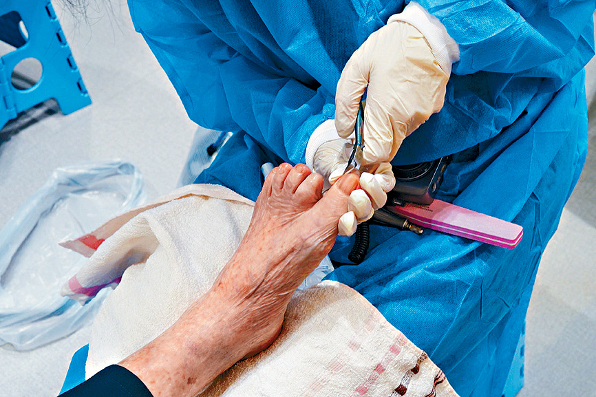 吳詠珊指出，不少長者將腳甲剪得過短，可能導致甲溝炎、倒甲，甚至是具傳染性的灰甲。