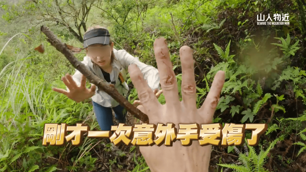 男網紅一手傷痕。(Youtube頻道「山人物近」截圖) 男網紅一手傷痕。(Youtube頻道「山人物近」截圖)