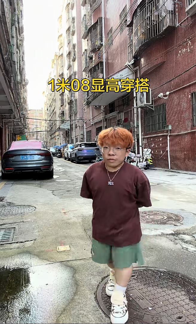 「刺刺背心」因基因突變令身高停留在1.08米。