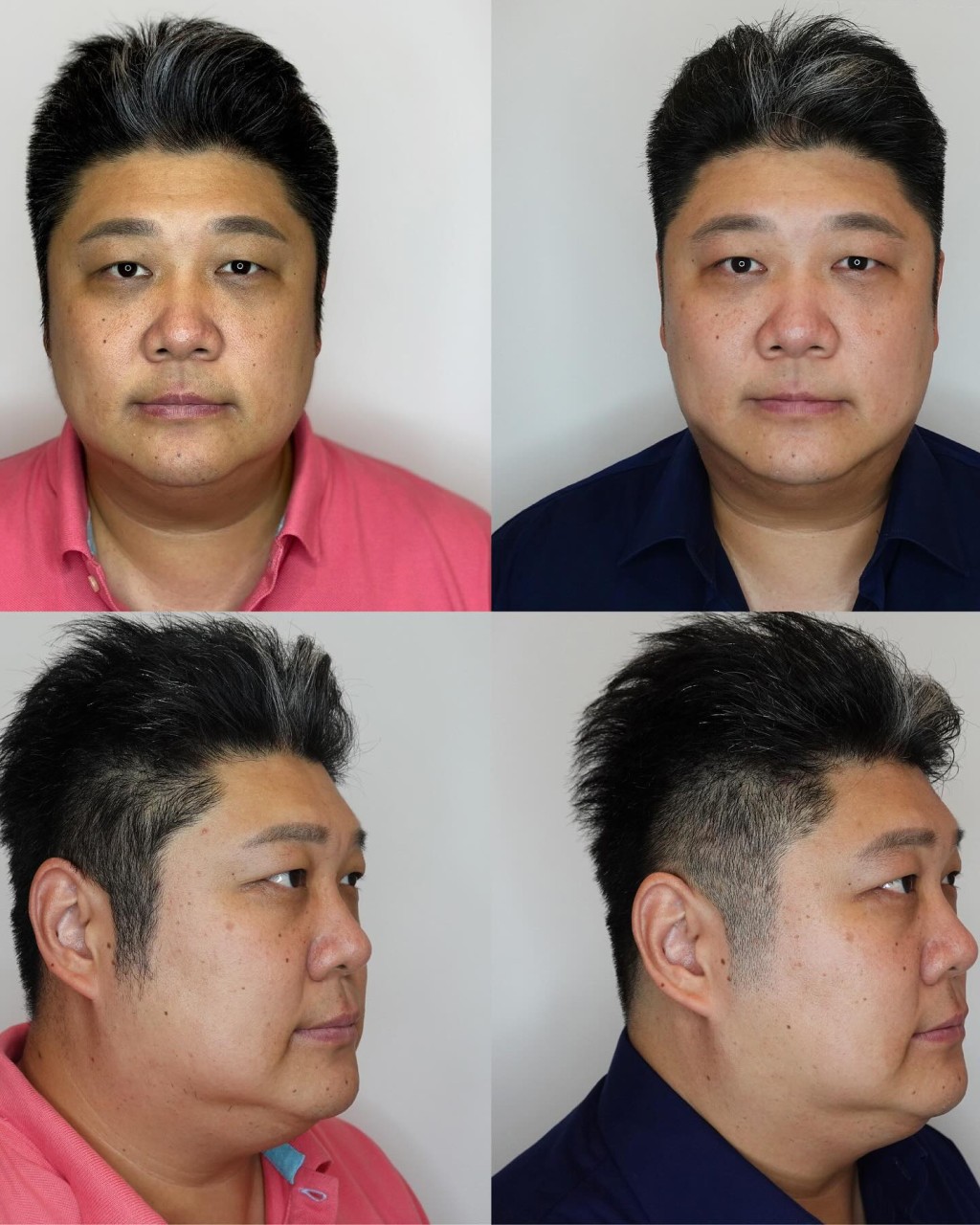 哈孝遠體重一直飆升。 哈孝遠體重一直飆升。