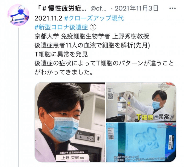 京都大學的上野英樹教授分析長新冠患者的疲勞症狀成因。