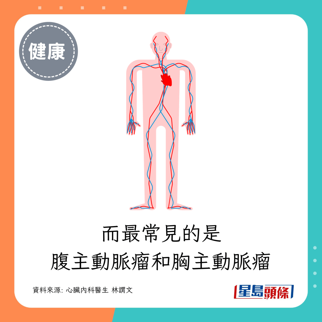 腹主動脈瘤和胸主動脈瘤最常見