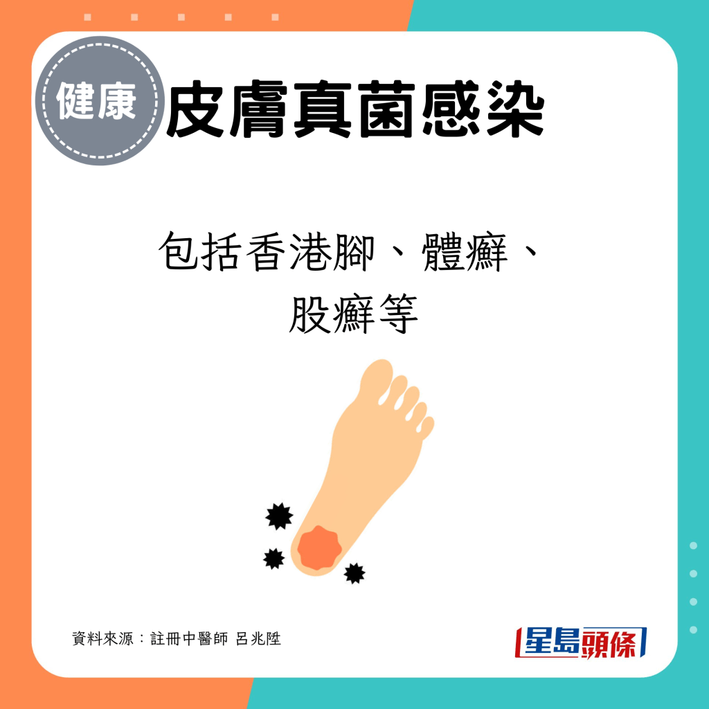 立夏節氣｜易引發的病症：香港腳、體癬、股癬等