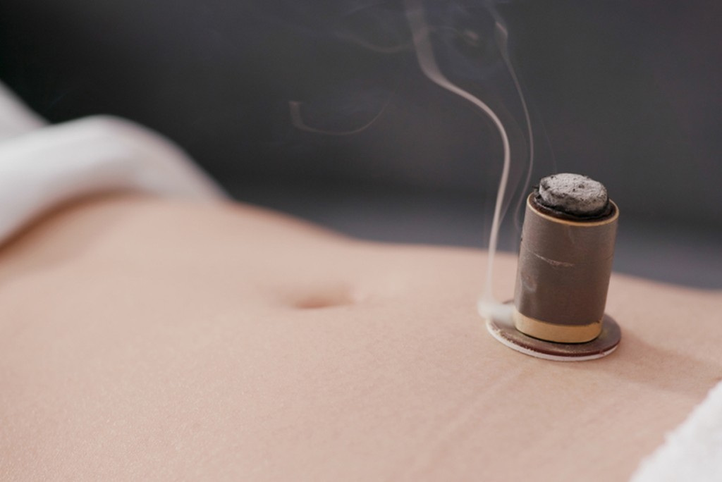 艾灸對於修身有一定的功效。