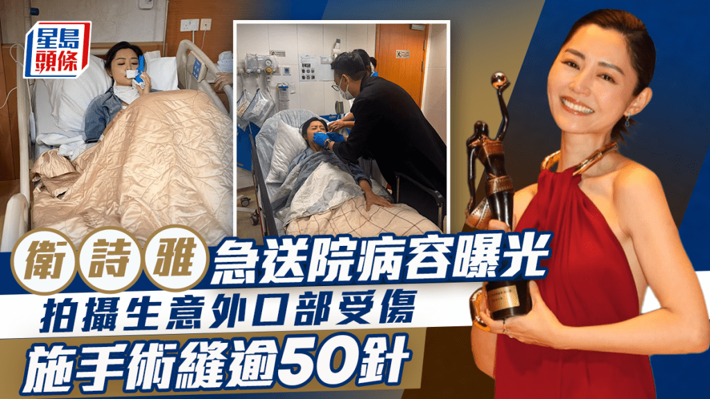衛詩雅發生意外急送院病容曝光  口部受傷急施手術縫逾50針  已返家休息全面停工