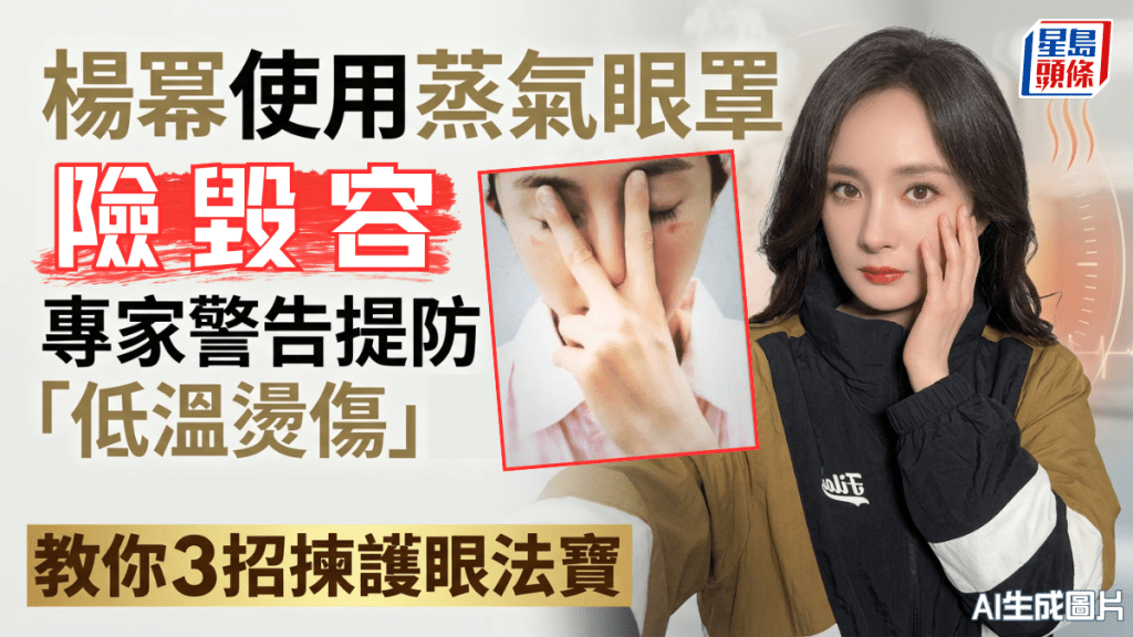 杨幂使用蒸气眼罩险毁容 专家警告提防「低温烫伤」 教你3招拣护眼法宝！