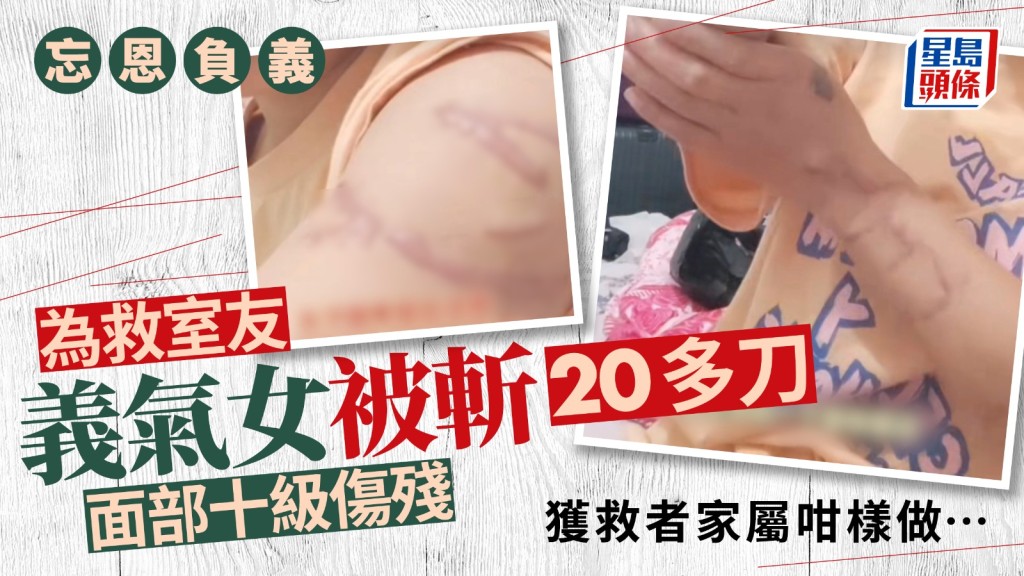 情侶爭執變砍人案，何女士無辜捲入其中被砍，肇事兩家人都對她不聞不問。