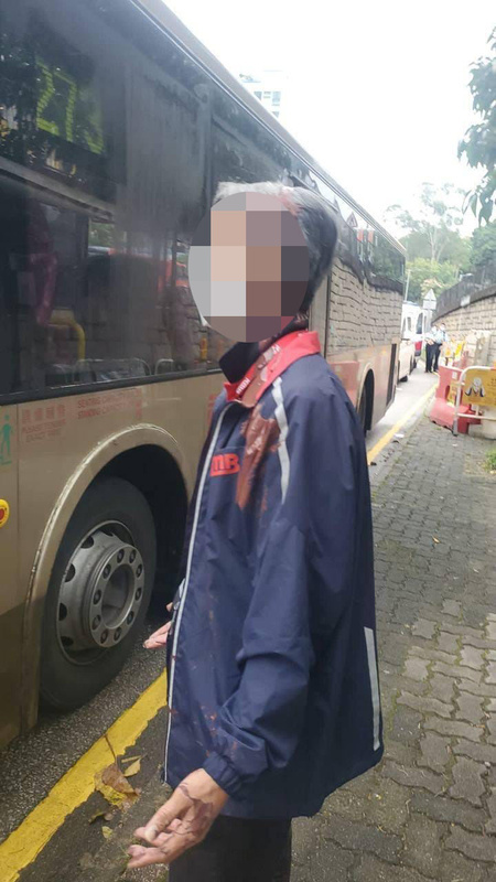 男车长头部、衣衫被波及。香港交通资讯网讨论区图片