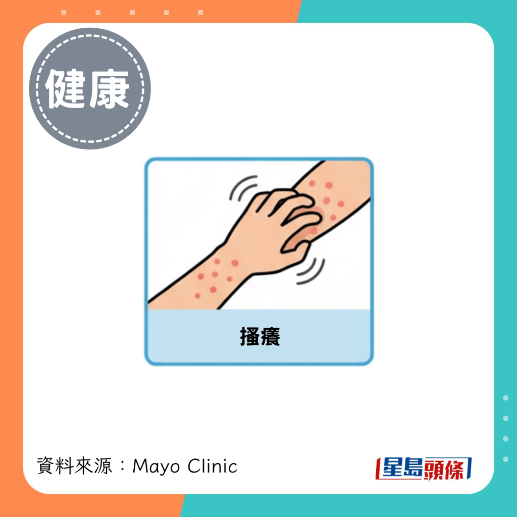 搔痒 搔痒