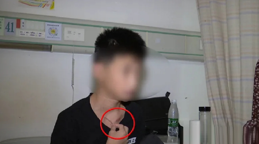 12歲的男童小家患上了肺癌末期,懷疑與生活習慣有關。網圖